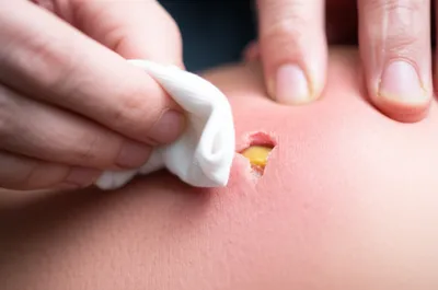 Illustration maturate - Image 1