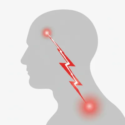 Illustration neuralgia
