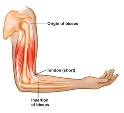 Illustration insertion - Image 2