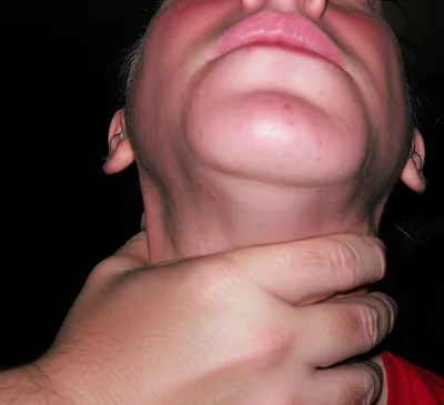 Illustration chokes - Image 1