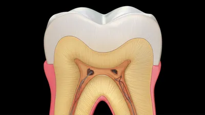 Illustration dentine