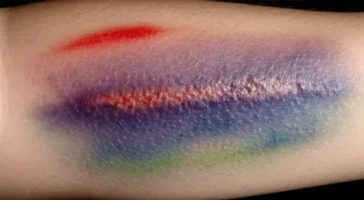 Illustration contusion - Image 1