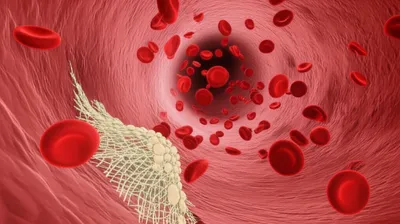 Illustration platelets