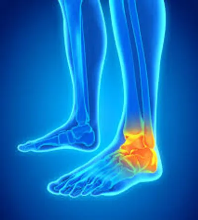 Illustration ankle - Image 2