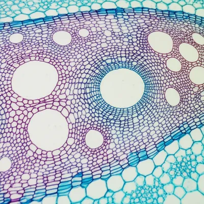 Illustration tracheae - Image 1