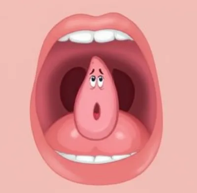 Illustration tonsils - Image 1