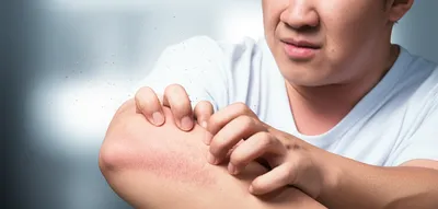 Illustration itching - Image 1