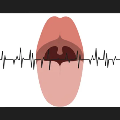 Illustration twangs - Image 1