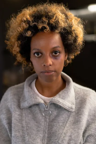 Illustration hematomas - Image 2