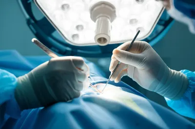 Illustration maneuver - Image 1