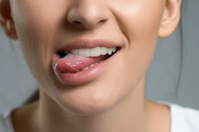 Illustration jibs - Image 1