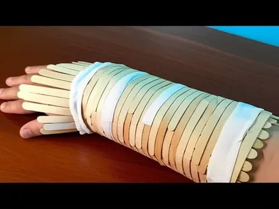 Illustration splinter - Image 1