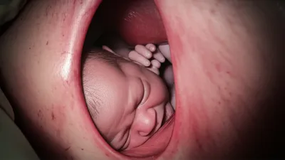 Illustration disengagement - Image 1