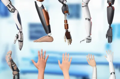 Illustration prosthesis - Image 1