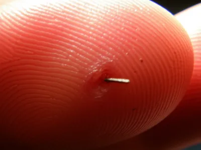 Illustration fester - Image 1