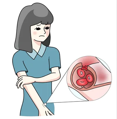 Illustration bleed - Image 1