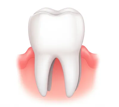 Illustration periodontal
