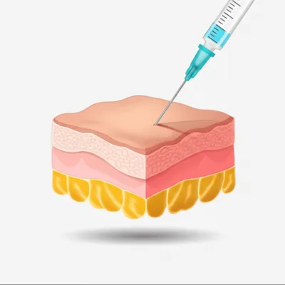 Illustration hypodermic - Image 1