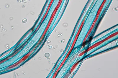 Illustration septa - Image 1