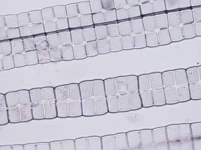 Illustration septum - Image 1