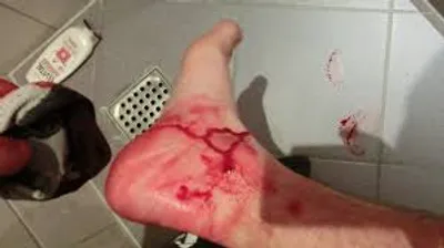 Illustration bleed - Image 3