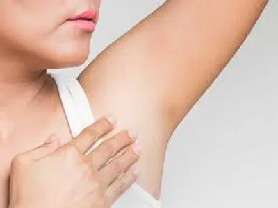 Illustration armpit - Image 2