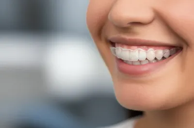 Illustration retainer - Image 1