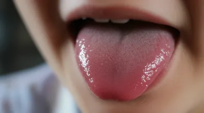 Illustration laminal - Image 1