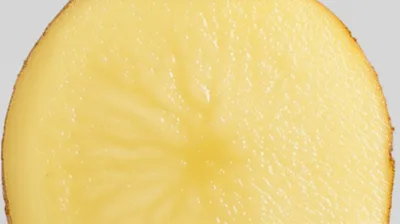 Illustration amyloid - Image 1