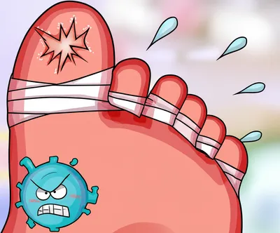 Illustration gout - Image 1