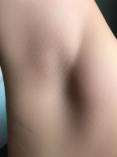 Illustration armpits