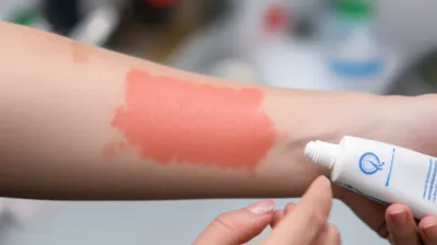 Illustration rash - Image 1