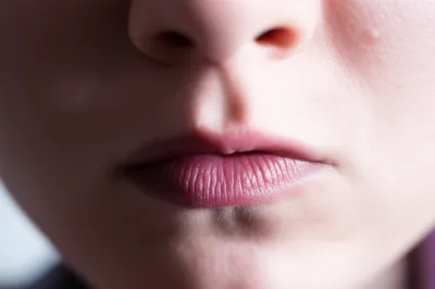 Illustration mumps - Image 1