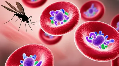 Illustration malaria - Image 1