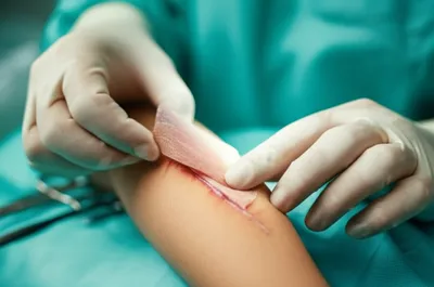 Illustration grafts - Image 1