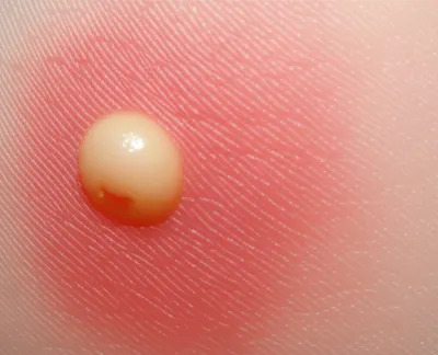 Illustration points - Image 1