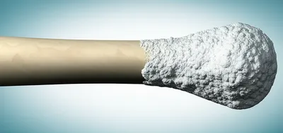 Illustration calcific - Image 1