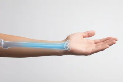 Illustration cubitus - Image 1