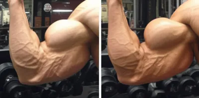 Illustration hypertrophy - Image 1