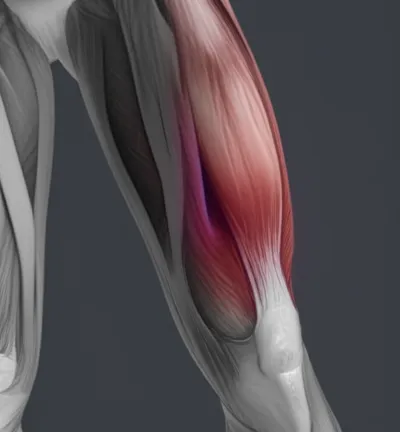 Illustration spasm - Image 1