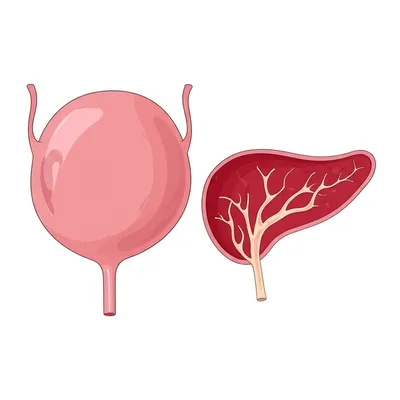 Illustration cyst - Image 1
