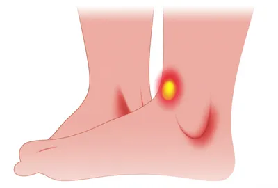 Illustration matter - Image 1