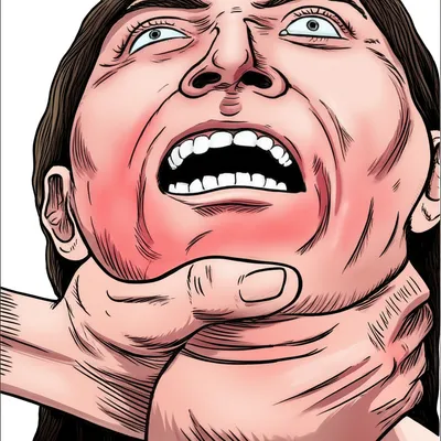 Illustration choke - Image 1