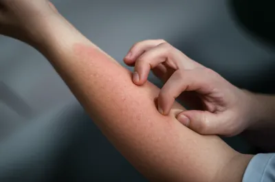 Illustration reefs - Image 1