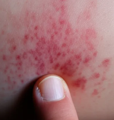 Illustration purpura - Image 1