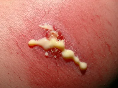 Illustration digested - Image 1