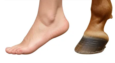 Illustration hoofs - Image 1