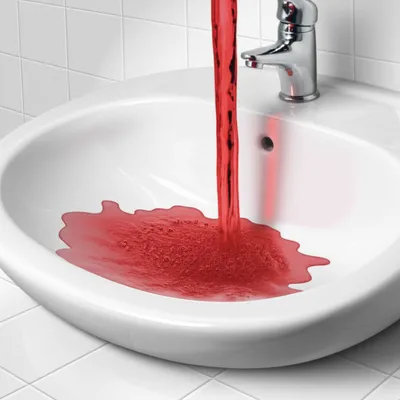 Illustration hemorrhage - Image 1