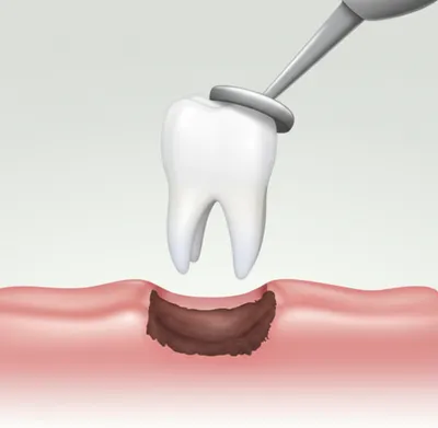 Illustration extracted