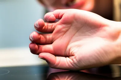 Illustration ouch - Image 1